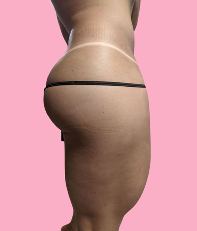 sexy thigh Melbourne tanned butt Florida woman airbrush spray tan line black thong lady pink